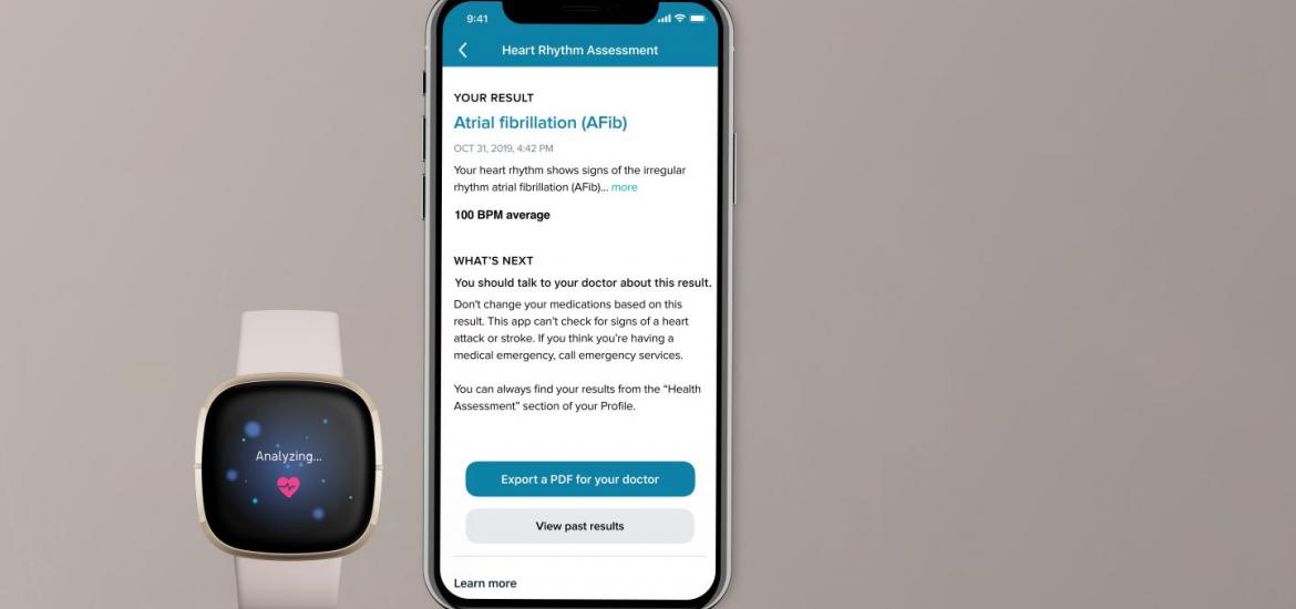 most advanced smartwatch 2019